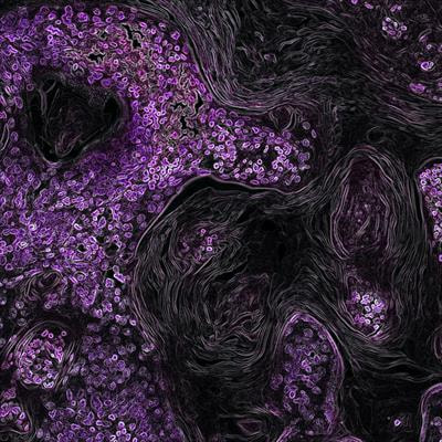 Cover image for research topic "Big Data and Machine Learning in Cancer Genomics"