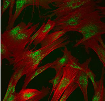 Cover image for research topic "The Role of Metabolism in MSC-Mediated Immunomodulation"