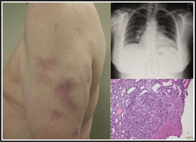 Cover image for research topic "Sarcoidosis – the great mimicker"