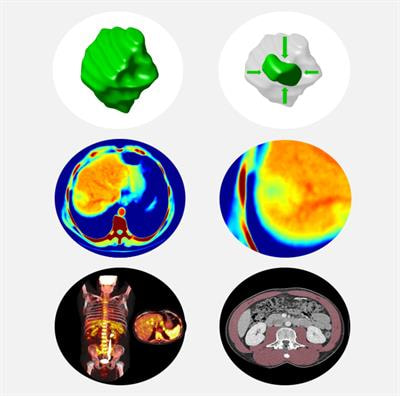 Cover image for research topic "Breakthrough in Imaging-Guided Precision Medicine in Oncology"
