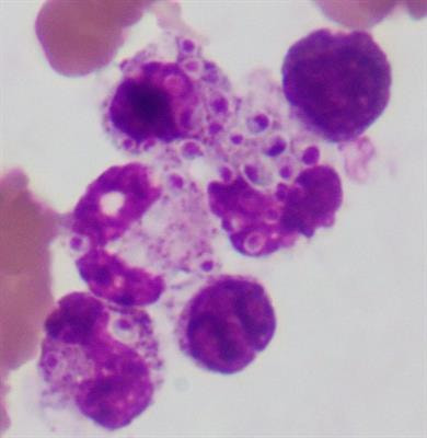 Cover image for research topic "Pathogenesis of Dimorphic Fungal Infections"
