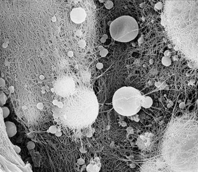 Cover image for research topic "Estrogen and Progesterone Axis in Human Cancers"
