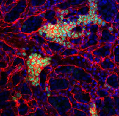 Cover image for research topic "Fetal/Embryonic Hematopoietic Progenitors and Their Impact on Adult Diseases"