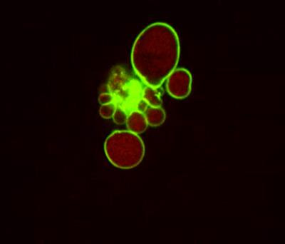 Cover image for research topic "Programmed Cell Death 2.0: The Quality of Cell Death"
