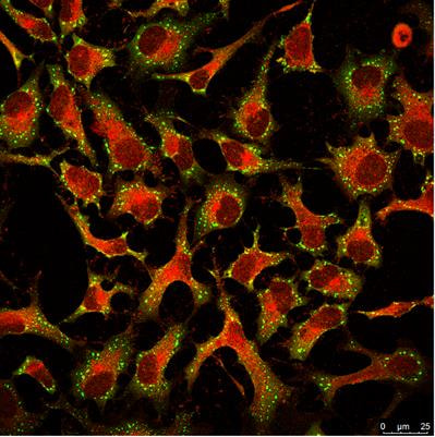 Cover image for research topic "The Dynamics of Stress Granules"
