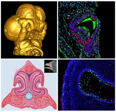 Cover image for research topic "Cellular Mechanisms during Normal and Abnormal Craniofacial Development"