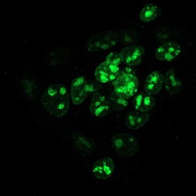 Cover image for research topic "Cellular Senescence: Causes, Consequences and Therapeutic Opportunities"
