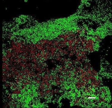 Cover image for research topic "Biofilms and the “One Health” Concept: Human, Animals and the Environment depending on Community Life"