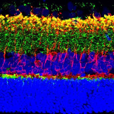 Cover image for research topic "Novel Nanotechnology for Diagnosing and Treating Eye Disorders"
