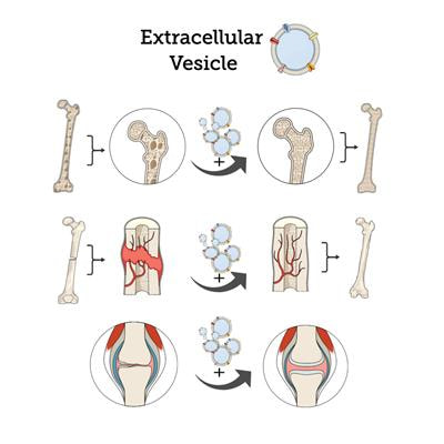 Cover image for research topic "Bone and Cartilage Regeneration with Extracellular Vesicles"