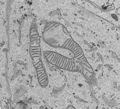Cover image for research topic "Metabolism in Alzheimer’s Disease "
