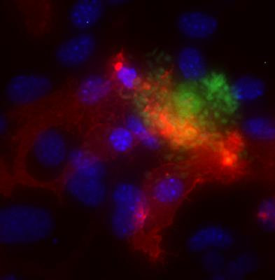 Cover image for research topic "The Relationships Between Infectious Agents and Dementia"