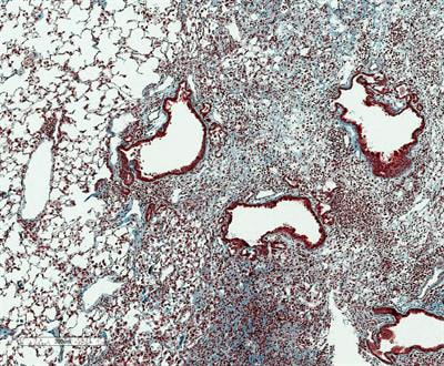 Cover image for research topic "Resident Memory T Cells: Guardians of the Balance of Local Immunity and Pathology"