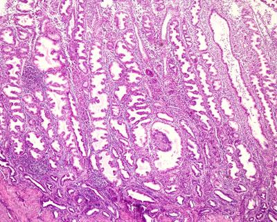 Cover image for research topic "Luteal Phase Support for Assisted Reproduction"