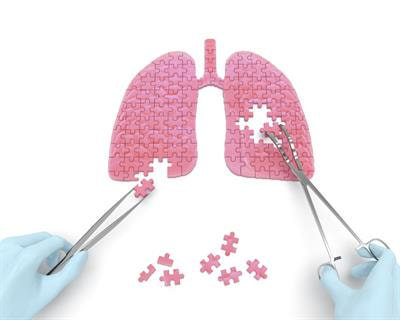 Cover image for research topic "From Development to Senescence, Bridging the Gap in Lung Fibrosis"