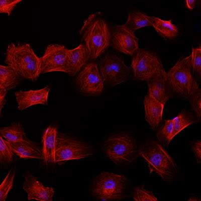 Cover image for research topic "The Role of Drug Resistance Mechanisms in Tumor Adaptation to Oxidative Stress"