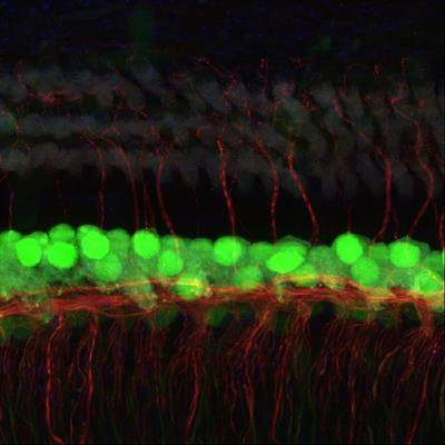 Cover image for research topic "Otologic Trauma, Pathology, and Therapy"