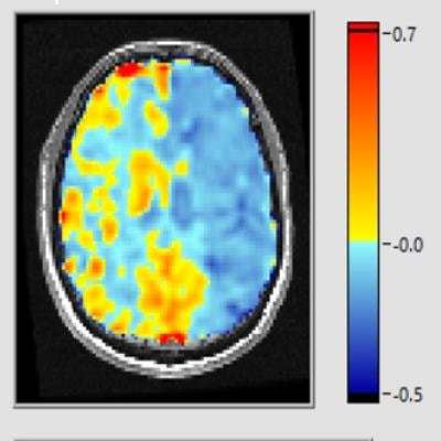 Cover image for research topic "Imaging Cerebrovascular Reactivity: Physiology, Physics and Therapy"