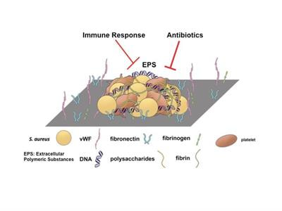 Cover image for research topic "Novel Insights into Biofilms in Infective Endocarditis"