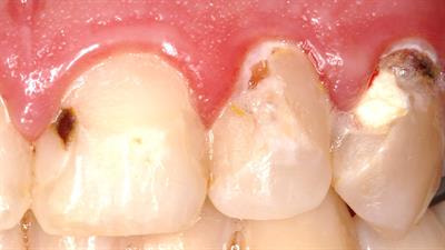 Cover image for research topic "Developing Bioactive Materials for Dental Applications"