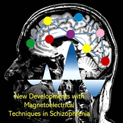 Cover image for research topic "New Developments with Magnetoelectrical Techniques in Schizophrenia"