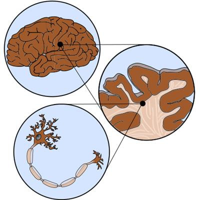 Cover image for research topic "Advances in Brain Mechanics"