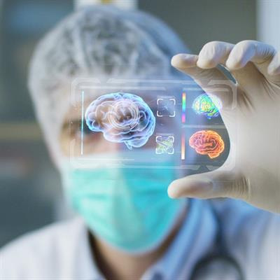 Cover image for research topic "Multi-Modal Imaging in Neurological Conditions: Translational Applications"