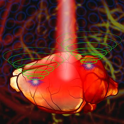Cover image for research topic "Advances in Photoacoustic Neuroimaging"