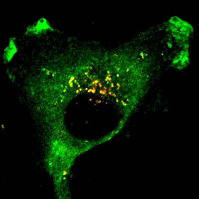 Cover image for research topic "Protein Sorting in the Endosomal Hub: a WASH of Old and New Players"