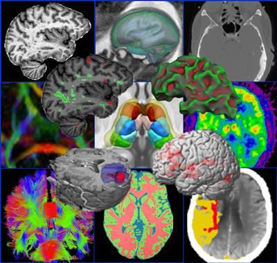 Cover image for research topic "Computational Neuroimage Analysis Tools for Brain (Diseases) Biomarkers"