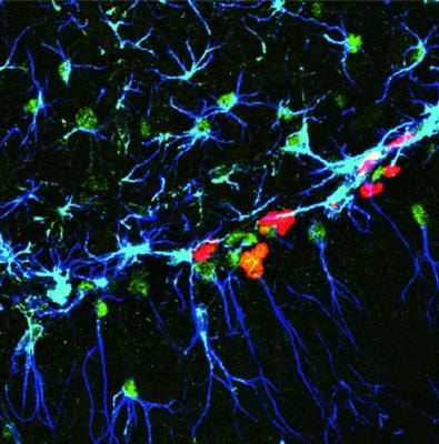Cover image for research topic "Neurorepair Strategies to Induce Angiogenesis, Neurogenesis and Synaptic Plasticity"
