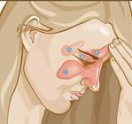 Cover image for research topic "Chronic rhinosinusitis in patients with  NSAID-exacerbated respiratory diseases"