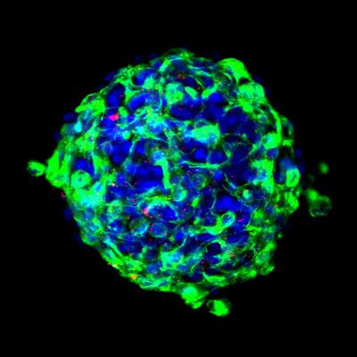 Cover image for research topic "3D Bioprinting of Vascularized Tissues for In Vitro and In Vivo Applications"