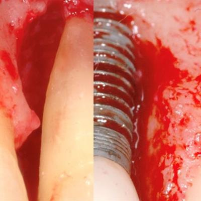 Cover image for research topic "Reviews in Periodontology"