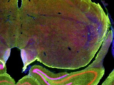 Cover image for research topic "Intraoperative fluorescence imaging and diagnosis in central and peripheral nervous system tumors: established applications and future perspectives"