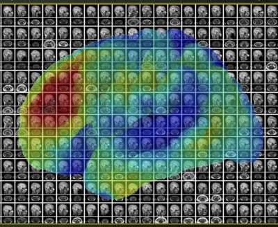 Cover image for research topic "Population Neuroscience of Development and Aging"