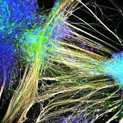 Cover image for research topic "Cell Therapy for Neurological Disorders"