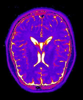 Cover image for research topic "Biotyping in Psychiatry"