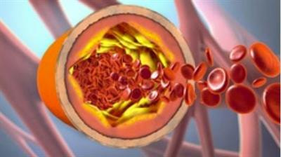 Cover image for research topic "Cerebrovascular Diseases and Neuropsychiatric Disorders in Aging"