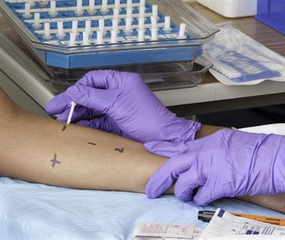 Cover image for research topic "Hot Topics in Food Allergy Diagnosis"