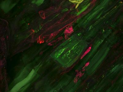 Cover image for research topic "The plant microbiome and its importance for plant and human health"