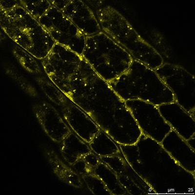 Cover image for research topic "Biology of Stress Granules in Plants"
