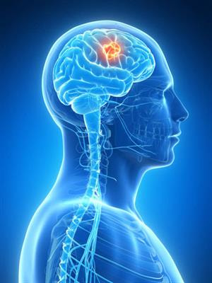 Cover image for research topic "Advanced Imaging of Glioma"