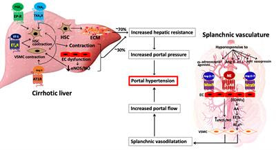 Cover image for research topic "Portal Hypertension in Cirrhosis: From Pathogenesis to Novel Treatments"