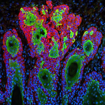 Cover image for research topic "New Tools and Molecular Advances in Hyperproliferative Skin Disorders"