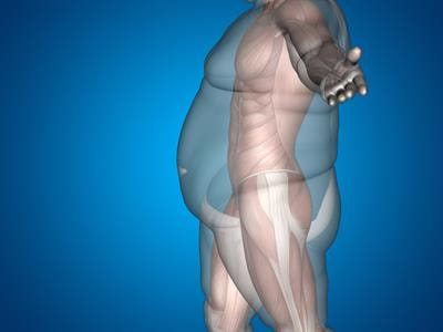 Cover image for research topic "Beyond Bariatric Surgery: Expected and Unexpected Long-Term Evolution"