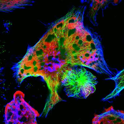 Cover image for research topic "Neuroblastoma: Signal Crosstalk and Future Insight into Clinical Trials"