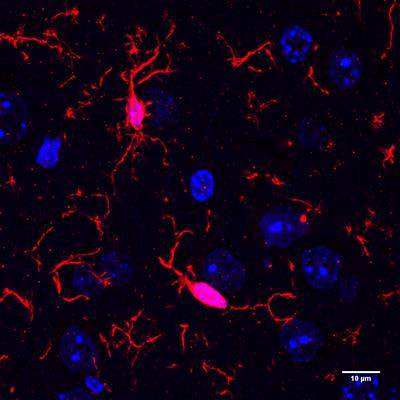 Cover image for research topic "Interactions of the gut microbiota and the innate immune system"