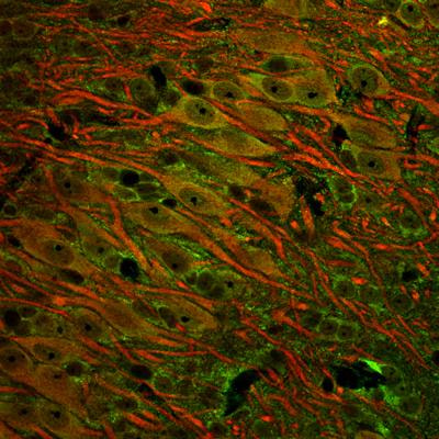 Cover image for research topic "Inhibitory Function in Auditory Processing"