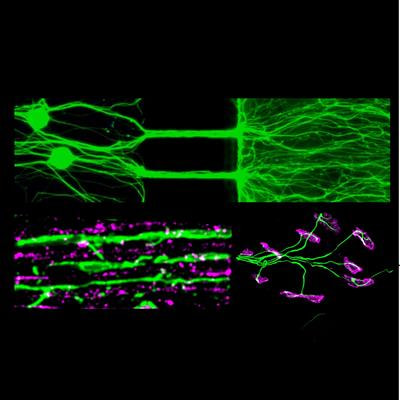 Cover image for research topic "Pathways and Processes Underpinning Axonal Biology and Pathobiology"